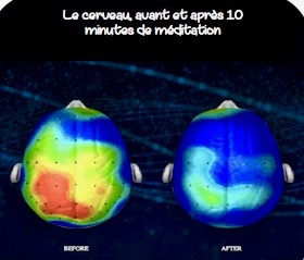 Le cerveau avant et après 10 mn de méditation Les effets de la méditation